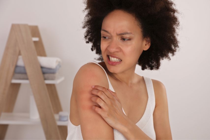 woman scratching eczema